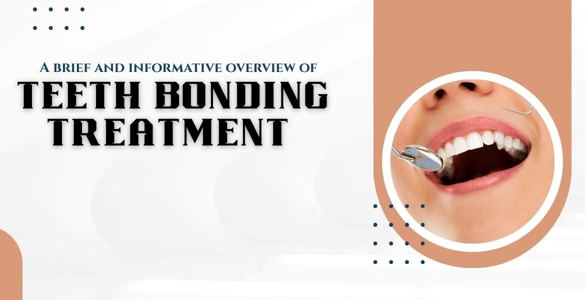 A brief and informative overview of teeth bonding treatment