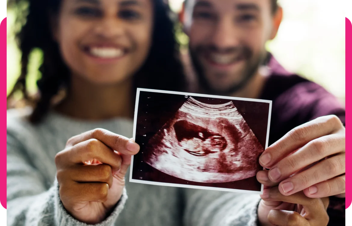 What Makes HD Live Ultrasound in Cypress TX a Game-Changer for Expecting Parents?