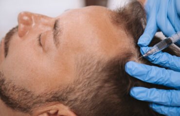 Hair Transplant Surgery