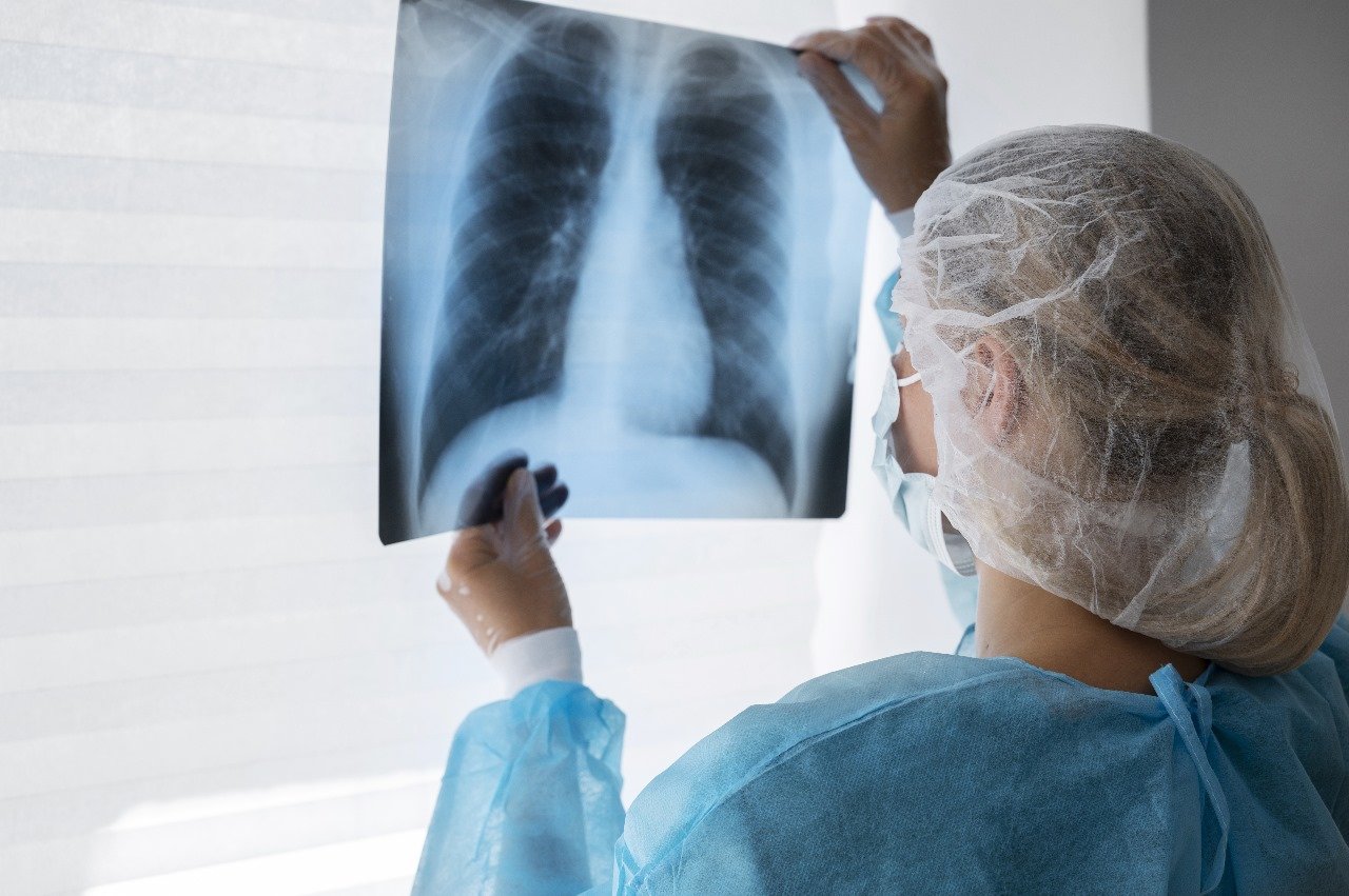 Interventional Pulmonology Services