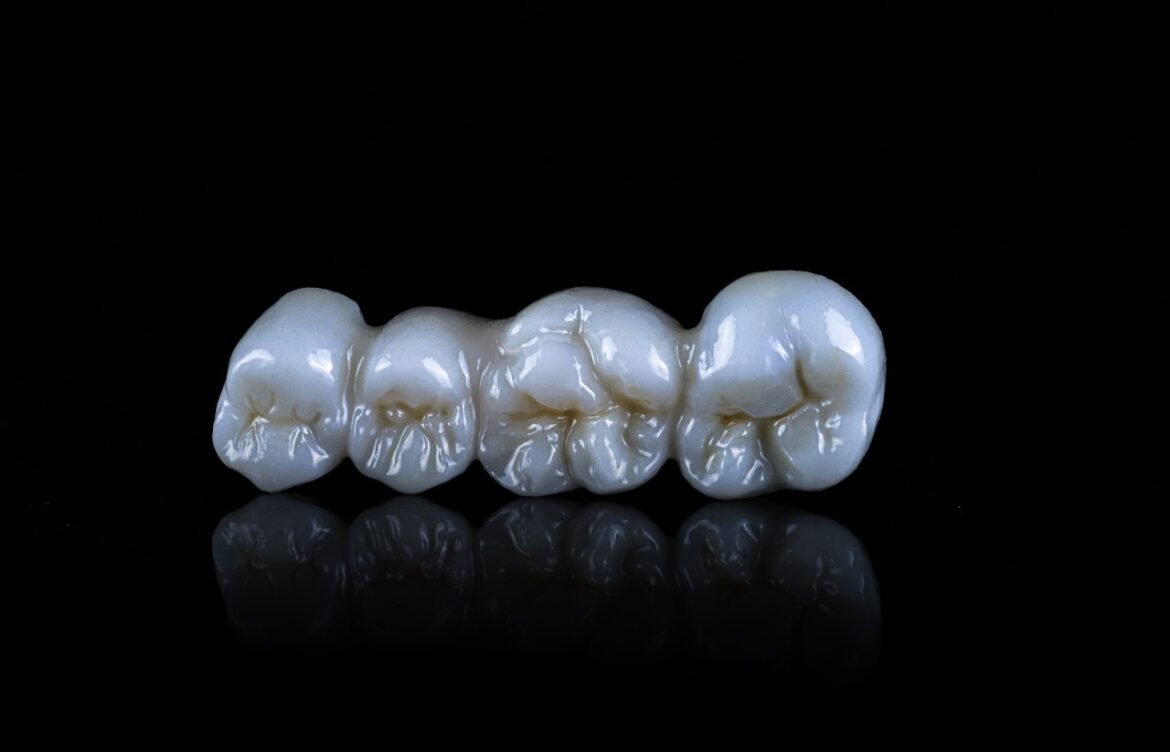 Why Zirconia Crowns Are Taking Over the Smile Game?
