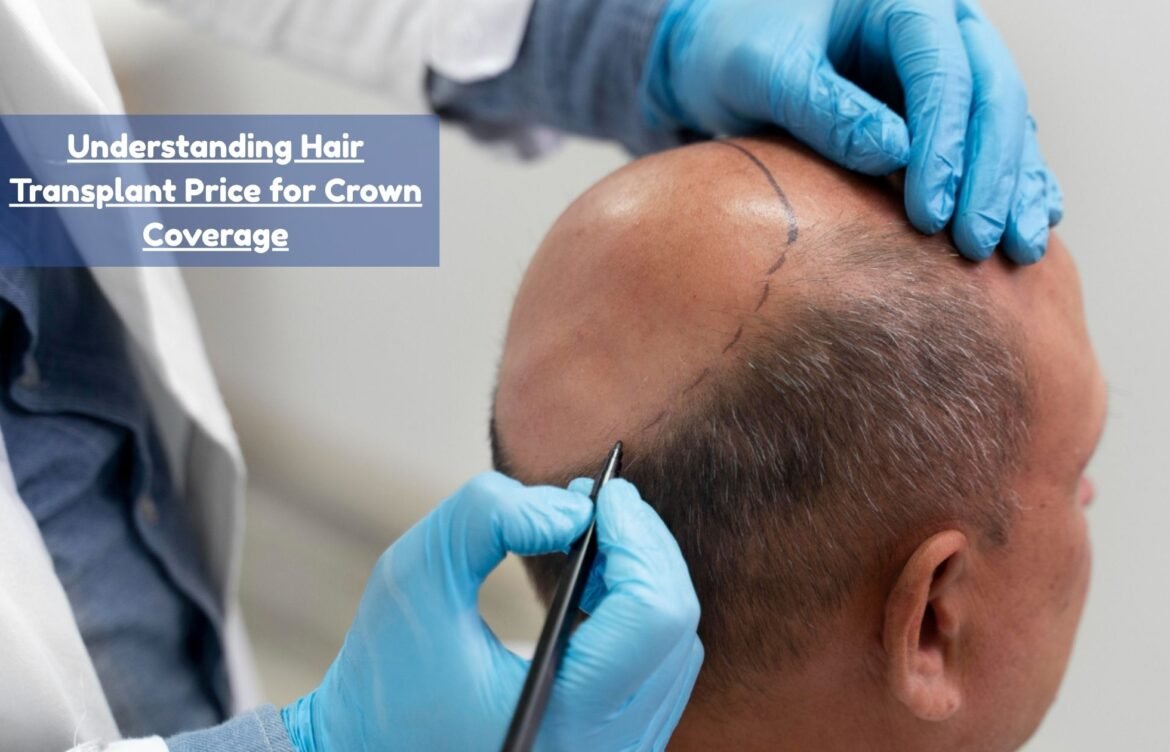 Understanding Hair Transplant Price for Crown Coverage