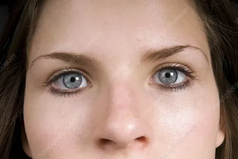Pinpoint Pupils After Medication: What’s Normal, What’s Not