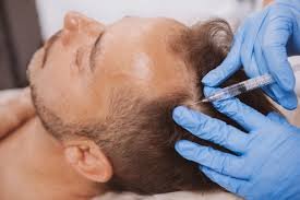 Why London’s Aesthetic Clinics Are the Go-To for Skincare Treatments