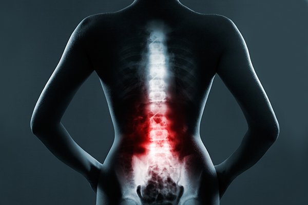 How Spine Issues Can Result In Leg Pain?