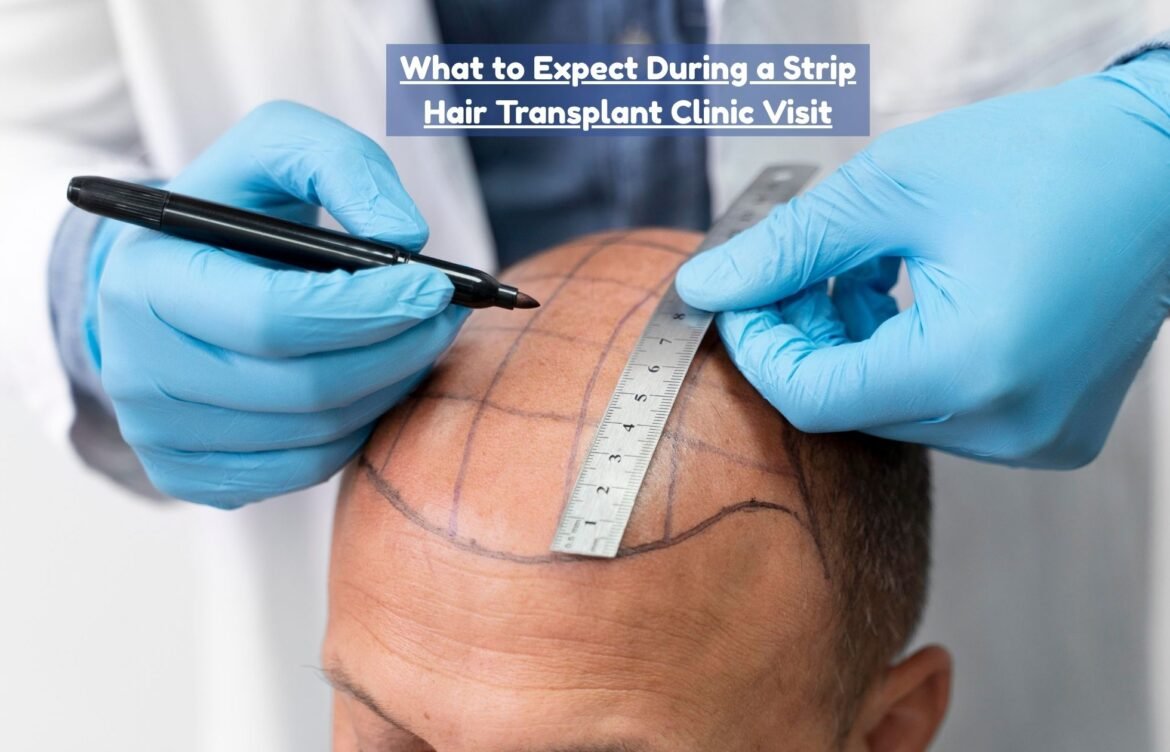 What to Expect During a Strip Hair Transplant Clinic Visit