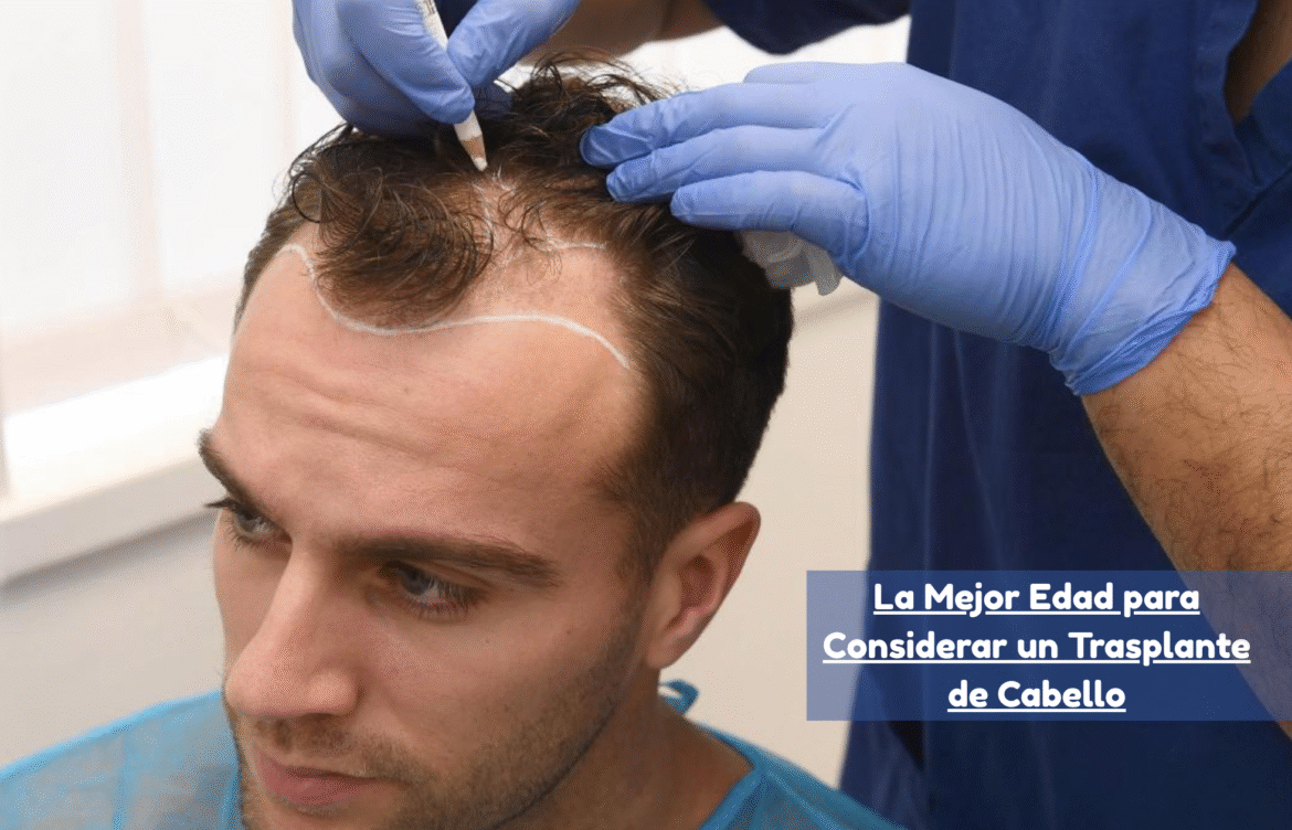 La Mejor Edad para Considerar un Trasplante de Cabello