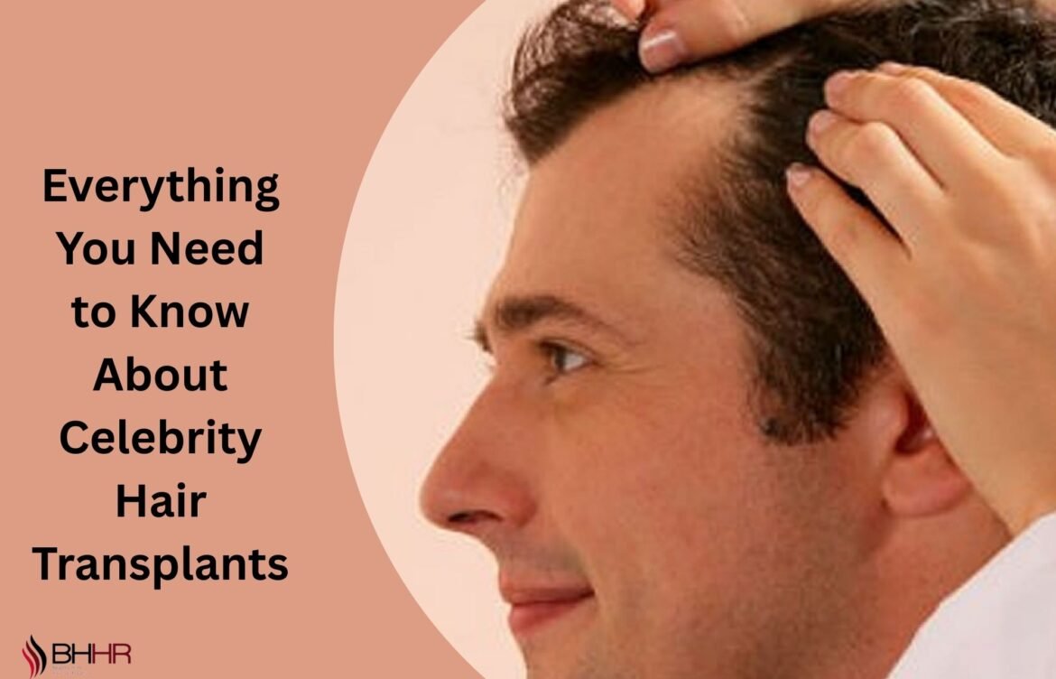 Everything You Need to Know About Celebrity Hair Transplants