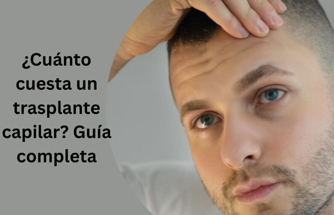 ¿Cuánto cuesta un trasplante capilar? Guía completa