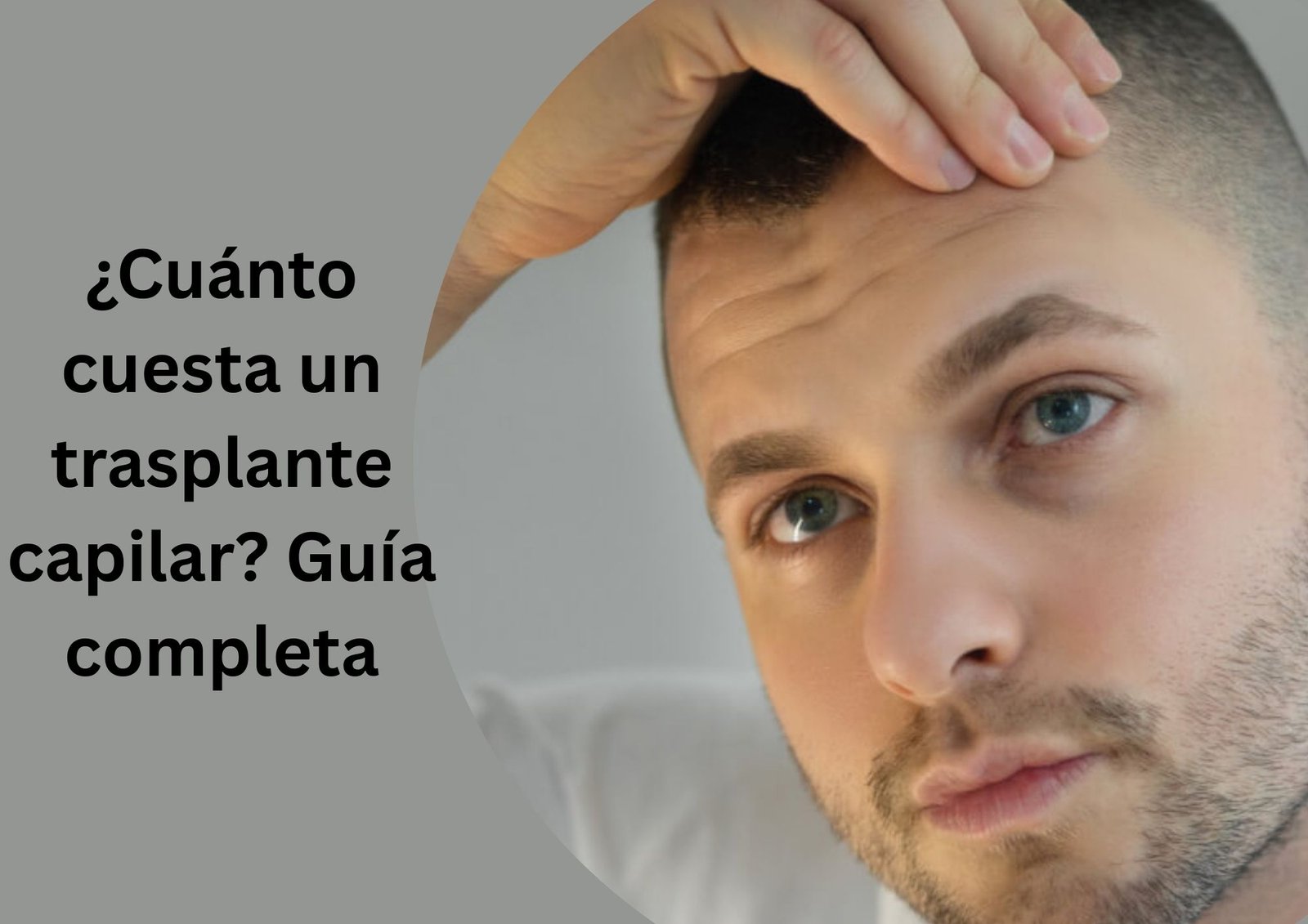 ¿Cuánto cuesta un trasplante capilar? Guía completa